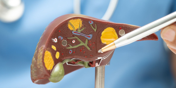 10 alimente care curăță ficatul: Ghid complet pentru detoxifiere naturală